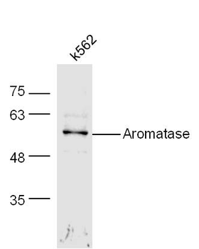 Aromatase Rabbit Polyclonal Antibody