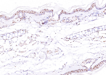 ATF4 Rabbit Polyclonal Antibody