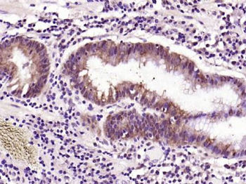 EGFR Rabbit Polyclonal Antibody