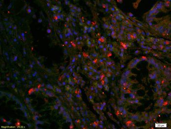 EGFR Rabbit Polyclonal Antibody