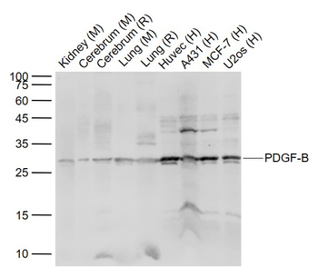 PDGF-B Rabbit Polyclonal Antibody