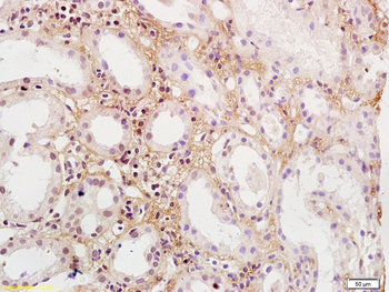 PDGFBB Rabbit Polyclonal Antibody