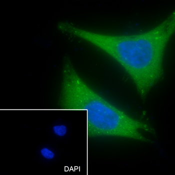 LHB Recombinant Rabbit Monoclonal Antibody
