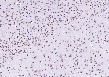 F(ab')₂ Fragment Goat Anti-Rabbit IgG H&L, HRP conjugated