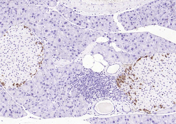 F(ab')₂ Fragment Goat Anti-Rabbit IgG H&L, HRP conjugated