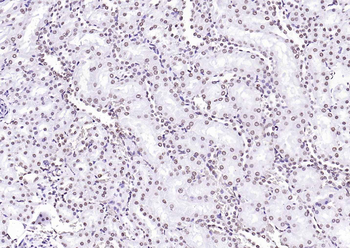 F(ab')₂ Fragment Goat Anti-Rabbit IgG H&L, HRP conjugated