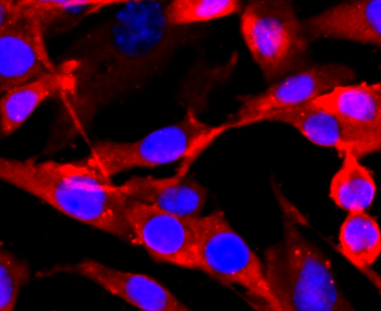 NMDAR1 Recombinant Rabbit Monoclonal Antibody