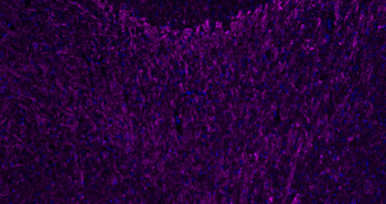 Donkey Anti-Rabbit IgG H&L, Cy5 conjugated