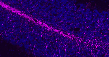 Donkey Anti-Rabbit IgG H&L, Cy5 conjugated