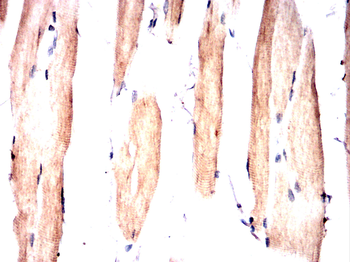 MAP2K7 Antibody