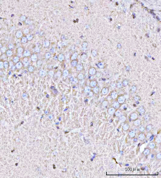 PPP3R1 Rabbit Polyclonal Antibody