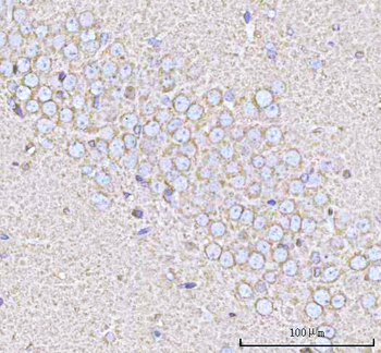 PPP3R1 Rabbit Polyclonal Antibody