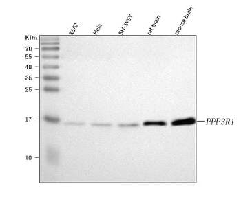 PPP3R1 Rabbit Polyclonal Antibody