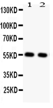 Glucose Transporter GLUT4/SLC2A4 Rabbit Polyclonal Antibody