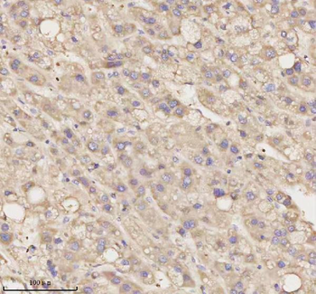 MEST Rabbit Polyclonal Antibody
