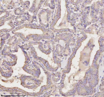 MEST Rabbit Polyclonal Antibody