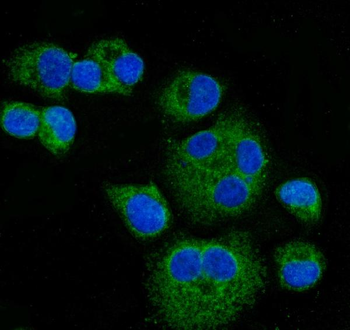 CPT1A Rabbit Polyclonal Antibody
