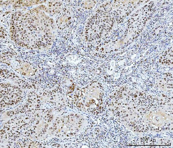 FEN1 Mouse Monoclonal Antibody