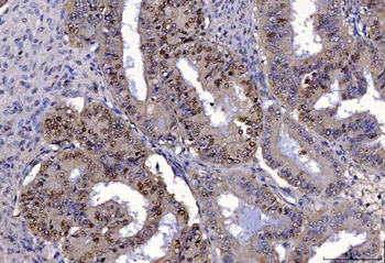 FEN1 Mouse Monoclonal Antibody