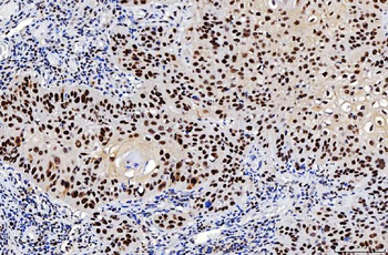 FEN1 Mouse Monoclonal Antibody