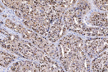 FEN1 Mouse Monoclonal Antibody