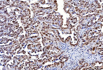 FEN1 Mouse Monoclonal Antibody