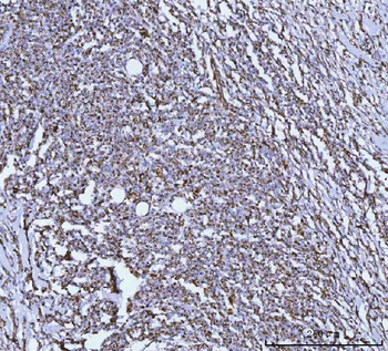 GLUD1/2 Rabbit Polyclonal Antibody