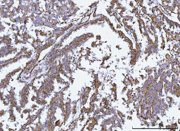 GLUD1/2 Rabbit Polyclonal Antibody