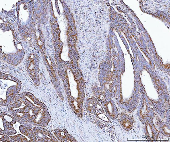GLUD1/2 Rabbit Polyclonal Antibody