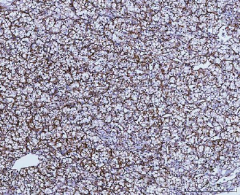 GLUD1/2 Rabbit Polyclonal Antibody
