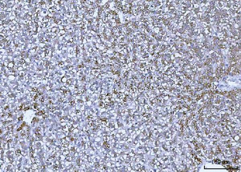 GLUD1/2 Rabbit Polyclonal Antibody