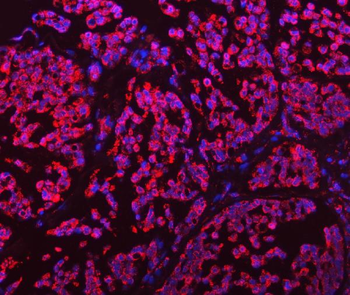 GLUD1/2 Rabbit Polyclonal Antibody