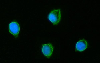 GLUD1/2 Rabbit Polyclonal Antibody