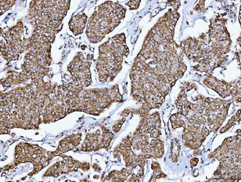 GLUD1/2 Rabbit Polyclonal Antibody