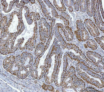 GLUD1/2 Rabbit Polyclonal Antibody