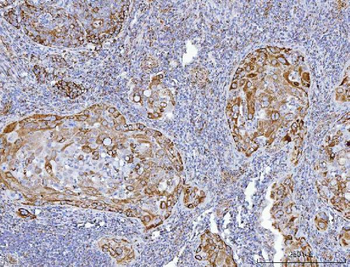 GLUD1/2 Rabbit Polyclonal Antibody