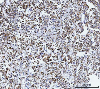 GLUD1/2 Rabbit Polyclonal Antibody