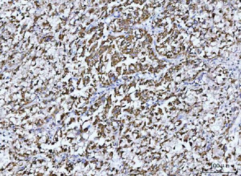 GLUD1/2 Rabbit Polyclonal Antibody