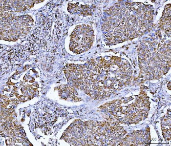 GLUD1/2 Rabbit Polyclonal Antibody