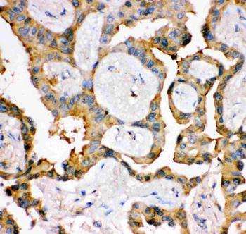 IRS1 Rabbit Polyclonal Antibody