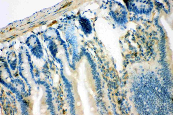 IRS1 Rabbit Polyclonal Antibody