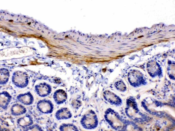 Nicotinic Acetylcholine Receptor alpha 5/CHRNA5 Rabbit Polyclonal Antibody