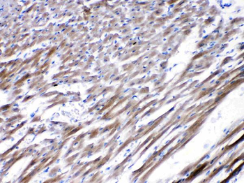 Nicotinic Acetylcholine Receptor alpha 5/CHRNA5 Rabbit Polyclonal Antibody