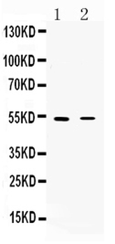 Nicotinic Acetylcholine Receptor alpha 5/CHRNA5 Rabbit Polyclonal Antibody