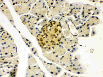 PAX6 Rabbit Polyclonal Antibody
