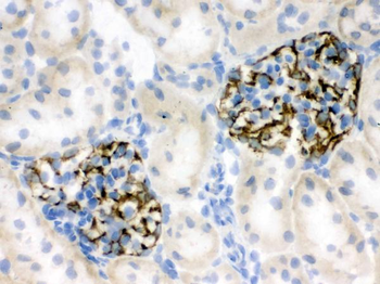 Nestin Rabbit Polyclonal Antibody