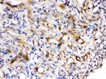 Nestin Rabbit Polyclonal Antibody