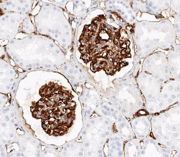 Nestin Rabbit Polyclonal Antibody