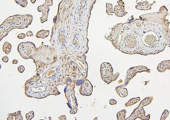 IRS1 Mouse Monoclonal Antibody