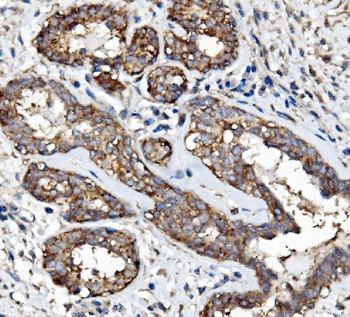 EGFR Rabbit Polyclonal Antibody